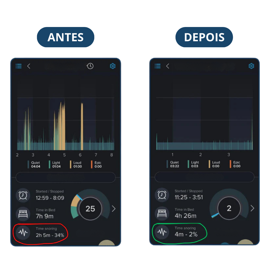 Sonar+ zenvita® - Protetor Bucal Anti-Ronco - OFERTA BLACK ESTENDIDA🔥 LEVE MAIS PAGANDO MENOS (ÚLTIMO DIA)