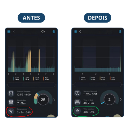 Sonar+ zenvita® - Protetor Bucal Anti-Ronco - OFERTA BLACK ESTENDIDA🔥 LEVE MAIS PAGANDO MENOS (ÚLTIMO DIA)